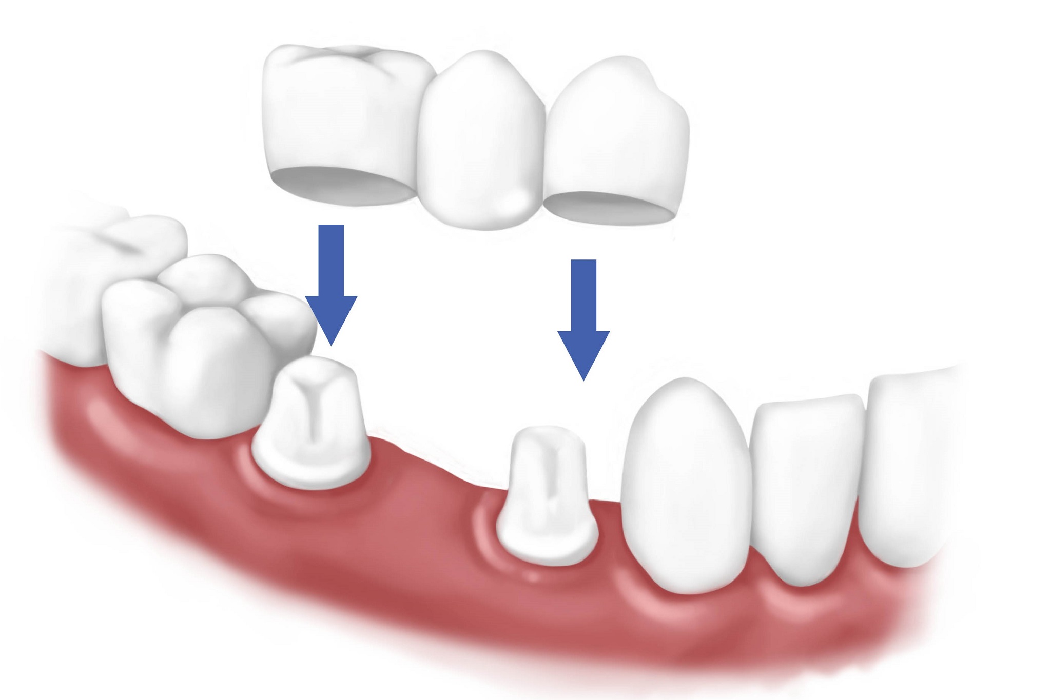 muskan dental care delhi17